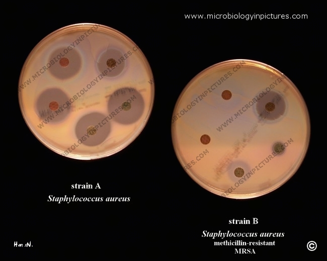 methicillin resistant Staphylococcus aureus (MRSA) colonies